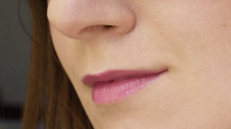 Тонкие губы являются показанием для коррекции